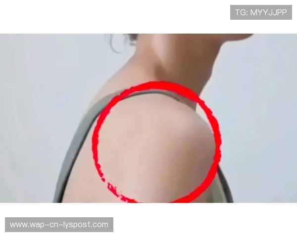 体态矫正“圆肩”:办公族的常见体态病 体态矫正“圆肩”:办公族的常见体态病